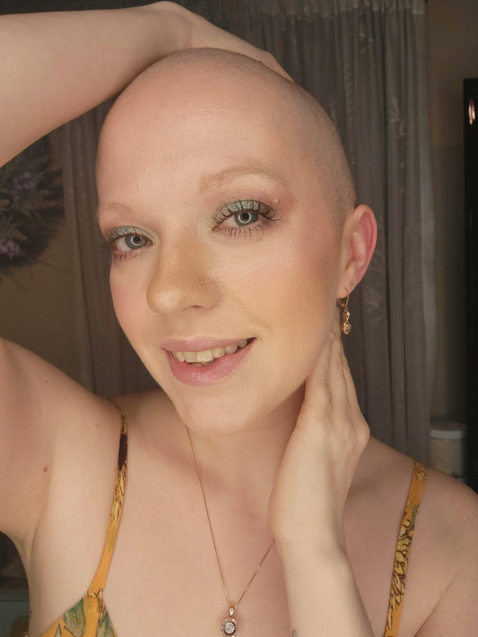 Embracing My True Reflection: A Journey of Female Hair Loss, Identity, and Self-Acceptance